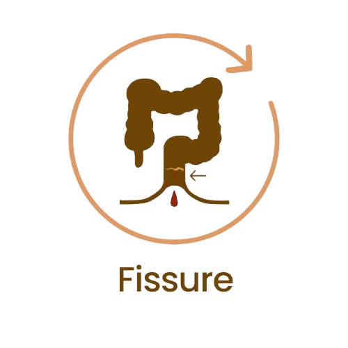 Fissure-2-removebg-preview